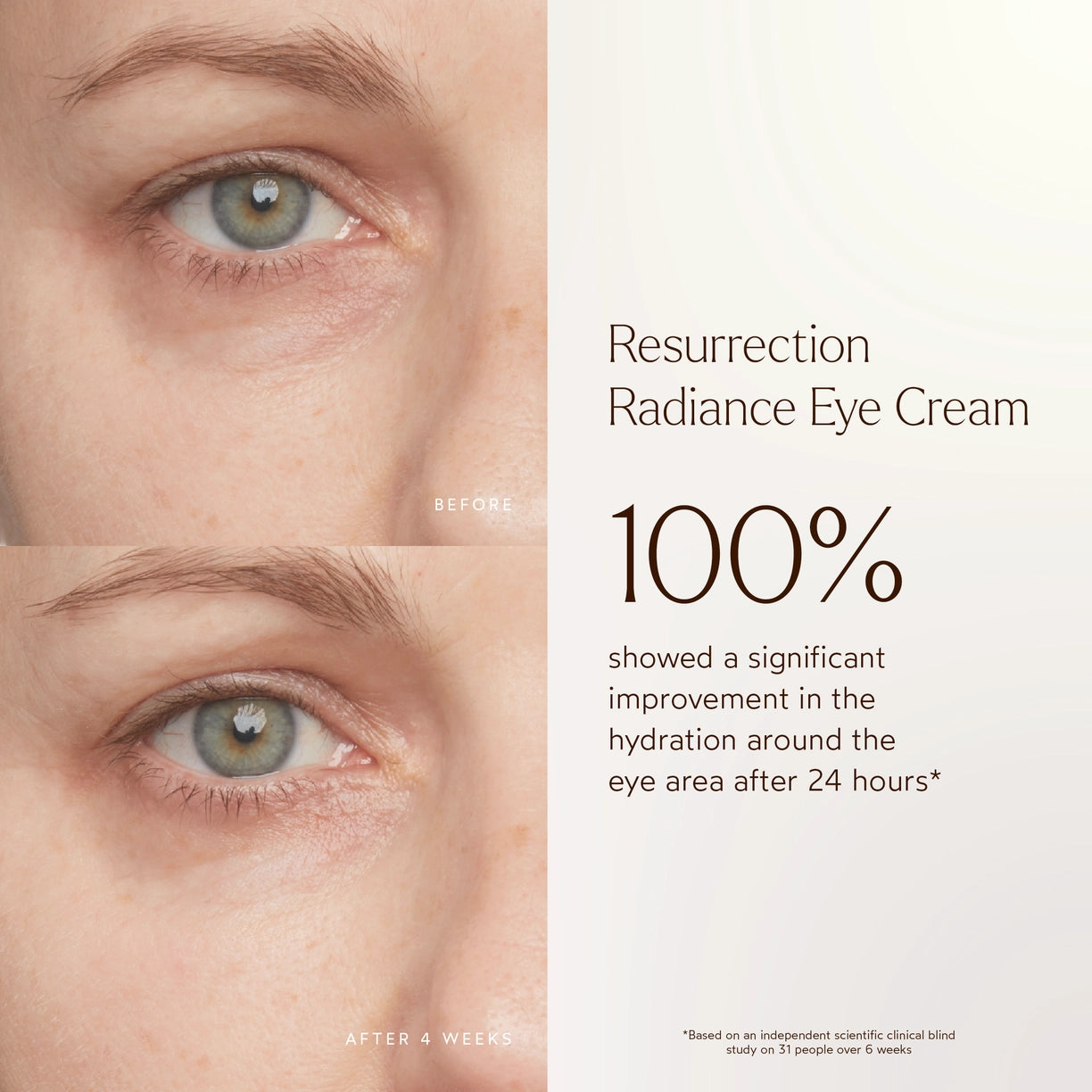 Renew Resurrection Radiance Eye Cream